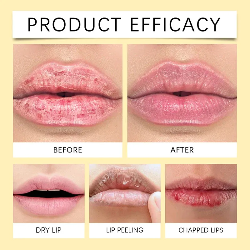 OUHOE Lip Balm